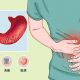 胃炎患者日常该注意什么？冬虫夏草对治疗胃炎有效果吗？