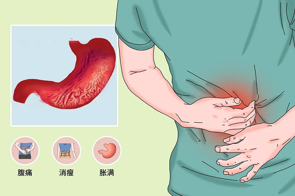 胃炎患者日常该注意什么？冬虫夏草对治疗胃炎有效果吗？
